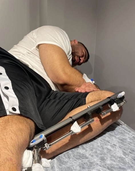 Мужчина потратил 100 тысяч евро, чтобы увеличить свой рост. «Вырос» до двух метров