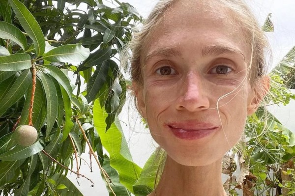 Умерла девушка, питавшаяся только фруктами — она весила чуть больше 20 кг